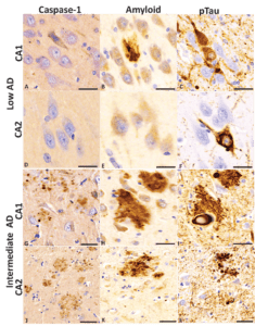 Inflammasome Expression
