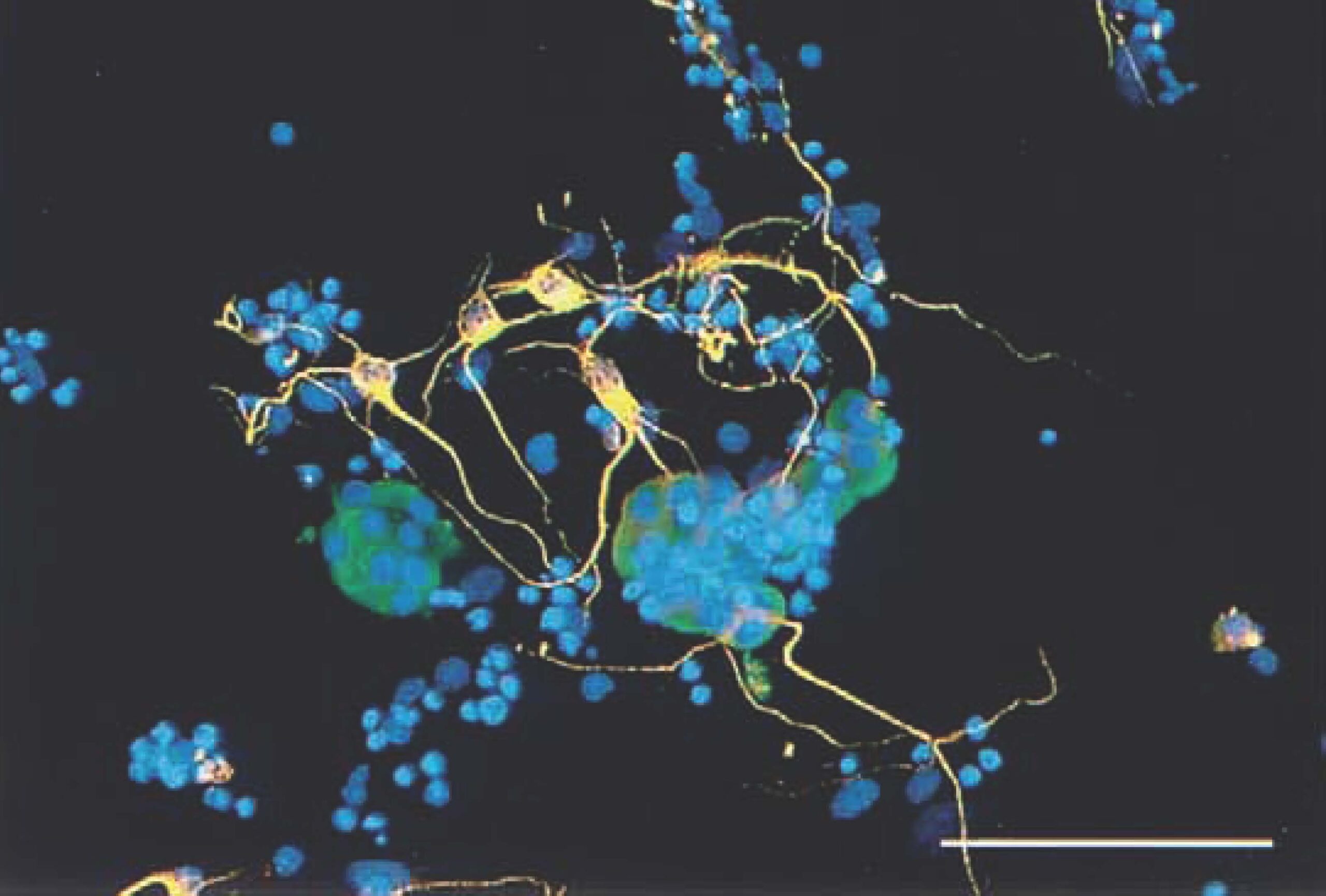 Neuronal progenitor cells from Dr. Sagen's lab
