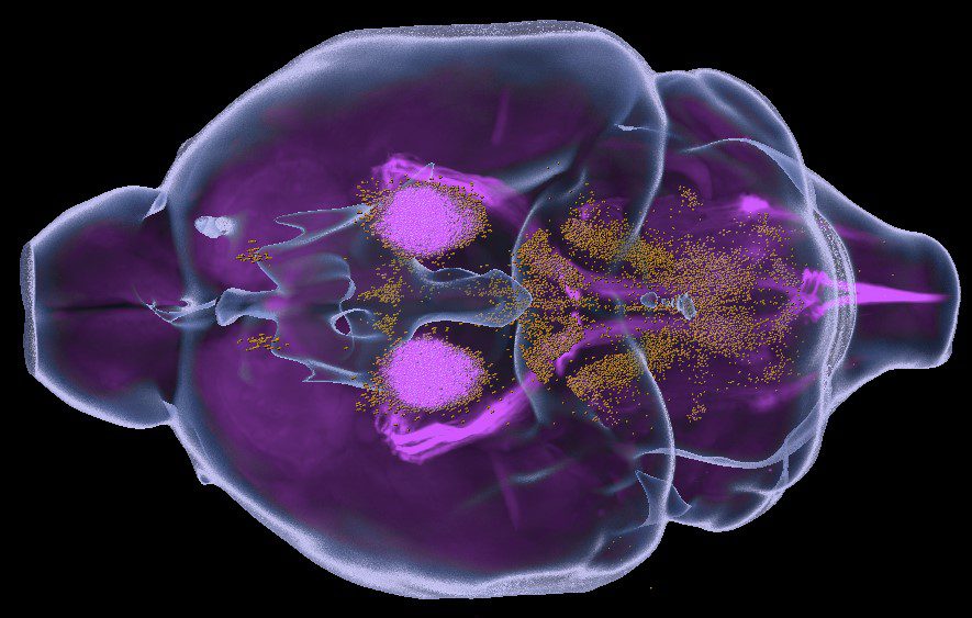 Dr. Tsoulfas mouse brain mapping
